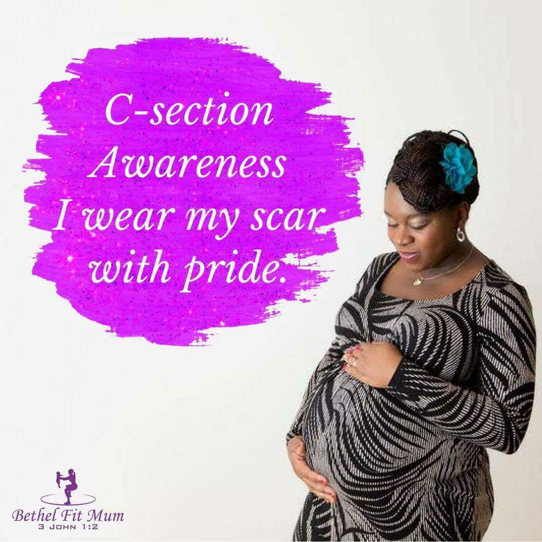 C- section Awareness I wear my scar with pride